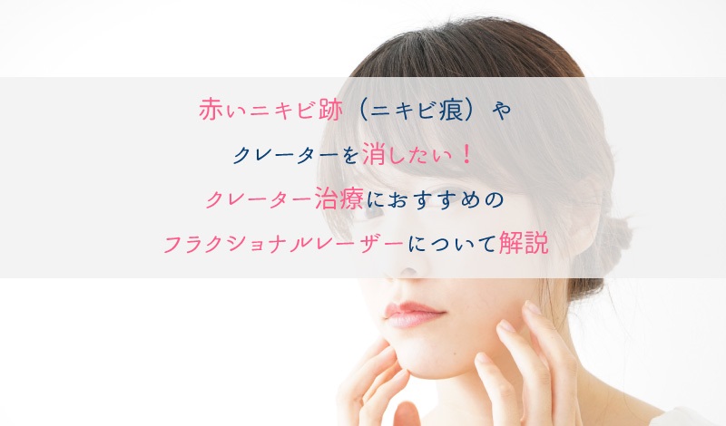 ニキビに対するネオスポリンの有効性