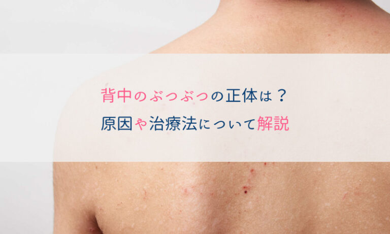 【医師監修】背中のぶつぶつの正体は？原因や治療法について解説 | はじめての美容医療 | ジェイメック